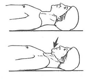 A two-part cartoon of the axial extension, first with a man laying on his back, spine straight, then with him tucking his chin in and down